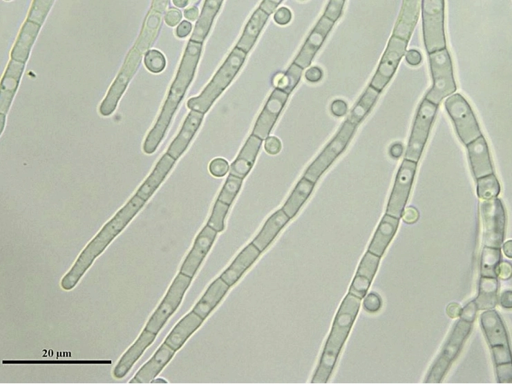 Image of Blastobotrys illinoisensis NRRL YB-1343