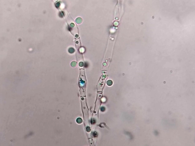 Image of Blastobotrys malaysiensis NRRL Y-6417