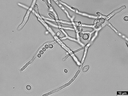 Image of Blastobotrys mokoenaii NRRL Y-27120